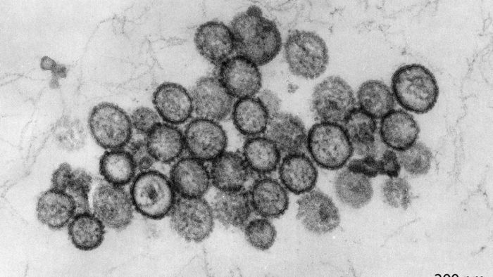 Experten rechnen mit starker Hantavirus-Verbreitung