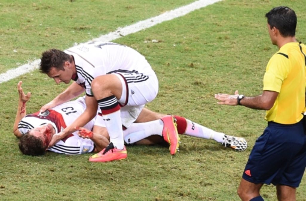 Thomas Müller hat sich beim Spiel gegen Ghana eine Platzwunde zugezogen, die genäht werden musste.