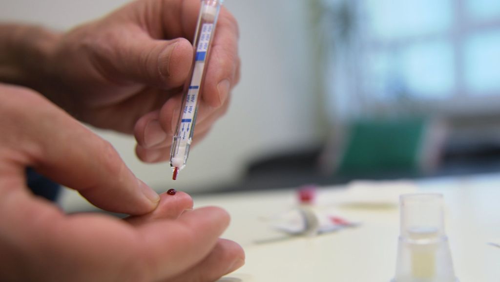 HIV-Tests für den Hausgebrauch: Ministerium prüft Zulassung