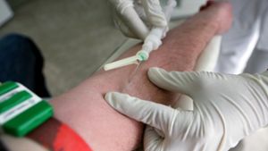 Früher Gewissheit beim HIV-Test