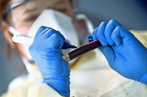 Eine Mitarbeiterin des Robert-Koch-Instituts (RKI) beschriftet eine Blutprobe. Für Corona-Tests zahlen bisher die Kassen, für Beatmungsgeräte der Staat. Foto: dpa/Marijan Murat