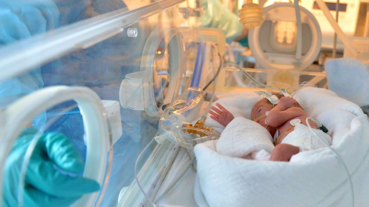 Kliniken in Baden-Württemberg: Bedrohte Frühgeborenen-Stationen sollen bleiben