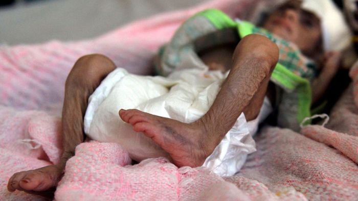 Unicef: Fast 500.000 Kinder in akuter Gefahr