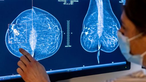 Brustkrebs ist die häufigste Krebserkrankung bei Frauen in Deutschland. Foto: Hannibal Hanschke/dpa