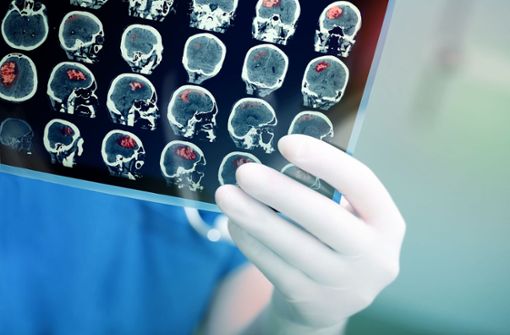 Ein Neurologe wertet  MRT-Bilder aus. Foto: sudokl/Adobe Stock