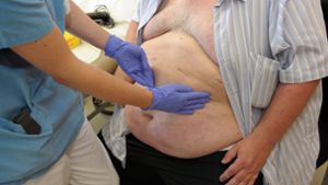 . Allein in England sind fast 63 Prozent der Erwachsenen zu dick. (Symbolbild) Foto: picture alliance / dpa/David Ebener