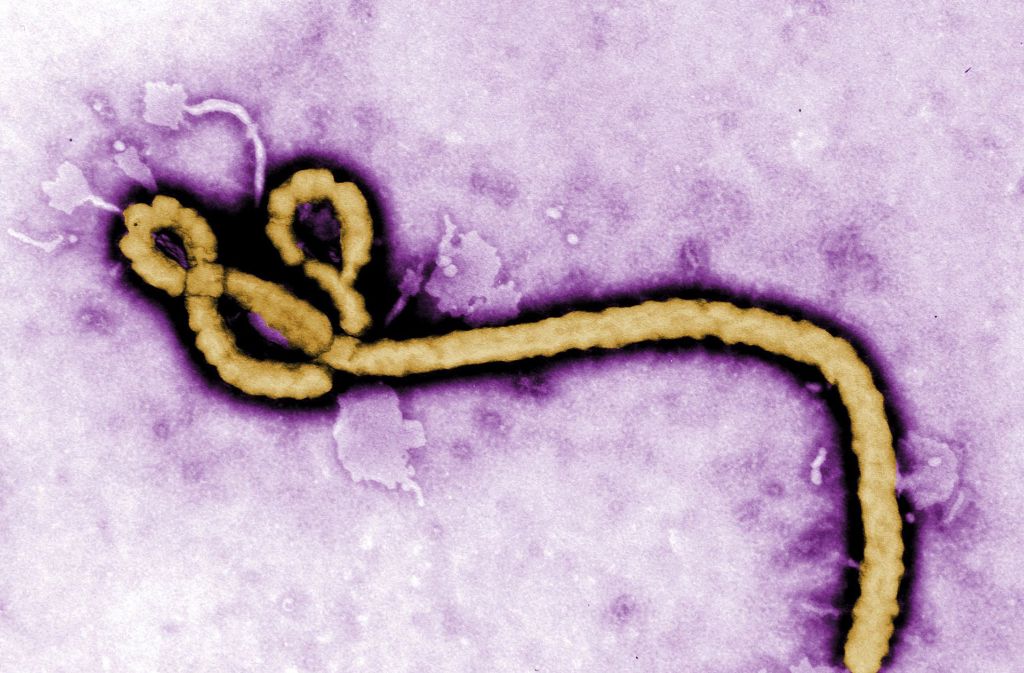 Laut Weltgesundheitsorganisation WHO ist die achte Ebola-Epidemie im Kongo ausgebrochen. Foto: CDC/AP