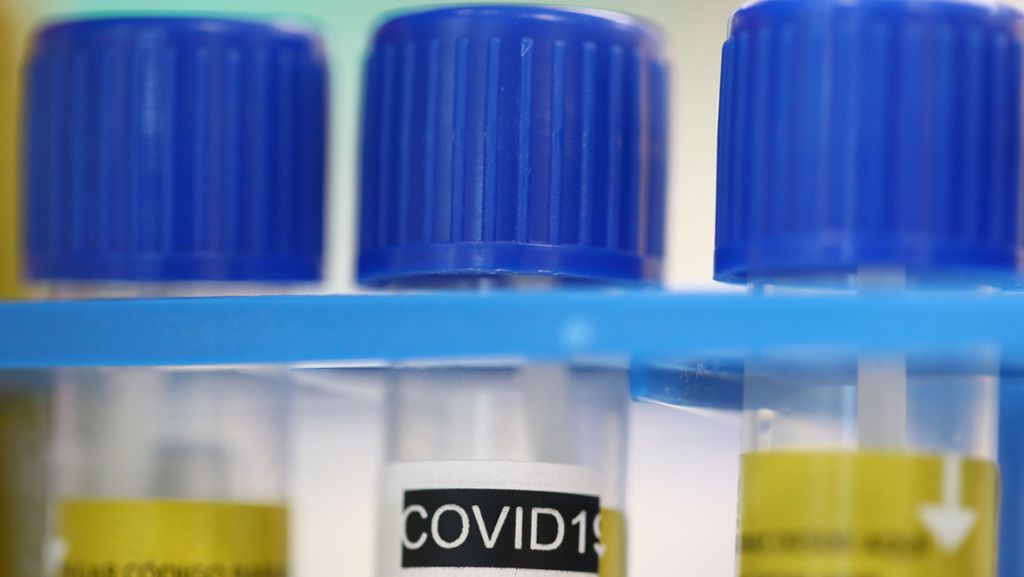 Coronavirus: Schützt Nikotin vor dem Virus?
