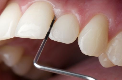 Ein Zahnarzt will einem Kollegen vor Gericht auf den Zahn fühlen. Foto: proDente e.V.