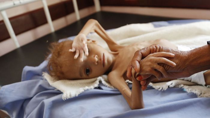 Das große Leid im Jemen