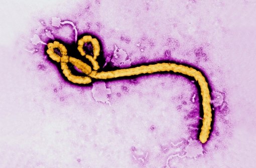 So sieht ein Ebola-Erreger unter dem Mikroskop aus. Foto: dpa/FREDERICK A. MURPY / CDC