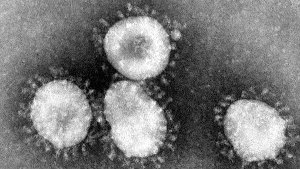 Das Handout des amerikanischen Centers for Disease Control (CDC) zeigt einen Coronavirus unter dem Mikroskop.  Foto: Center for Disease Control