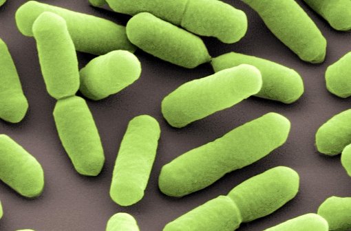 Listerien sind Bakterien, die vor allem für Menschen mit geschwächtem Immunsystem gefährlich sind. Foto: dpa