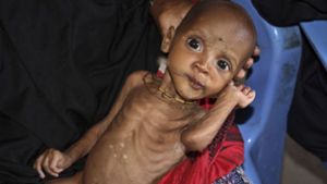 Dieses neun Monate alte Kind ist eines von Zehntausenden in Somalia, die akut vom Hungertod bedroht sind. Foto: AP