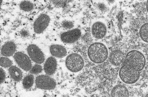 Diese elektronenmikroskopische Aufnahme aus dem Jahr 2003 zeigt reife, ovale Affenpockenviren (l) und kugelförmige unreife Virionen (r), die aus einer menschlichen Hautprobe von 2003 stammt. (Archivbild) Foto: dpa/Cynthia S. Goldsmith