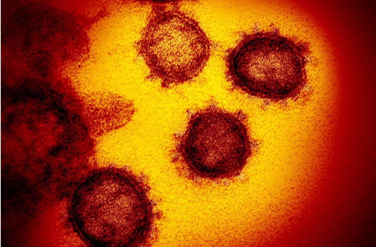 Die vom National Institute of Allergy and Infectious Diseases zur Verfügung gestellte Elektronenmikroskopaufnahme zeigt das Coronavirus SARS-CoV-2, das von einem Patienten in den USA isoliert wurde und aus der Oberfläche von im Labor kultivierten Zellen austritt. Foto: Niaid-Rml/Zuma Wire/pa